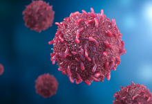 Câncer em jovens cresce no mundo: entenda os tipos mais comuns e o que está por trás dessa tendência