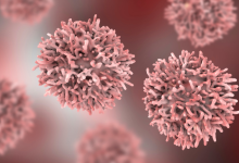 Sintomas de Câncer: Identificando Sinais Precoce para Agir a Tempo